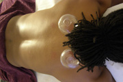 cupping